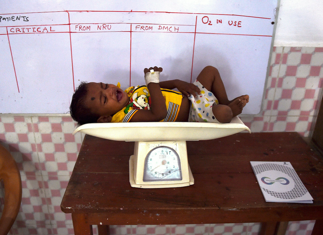 A two-year-old malnourished child lies on a weighing scale in a hospital in Darbhanga, India | MONEY SHARMA/AFP/Getty Images