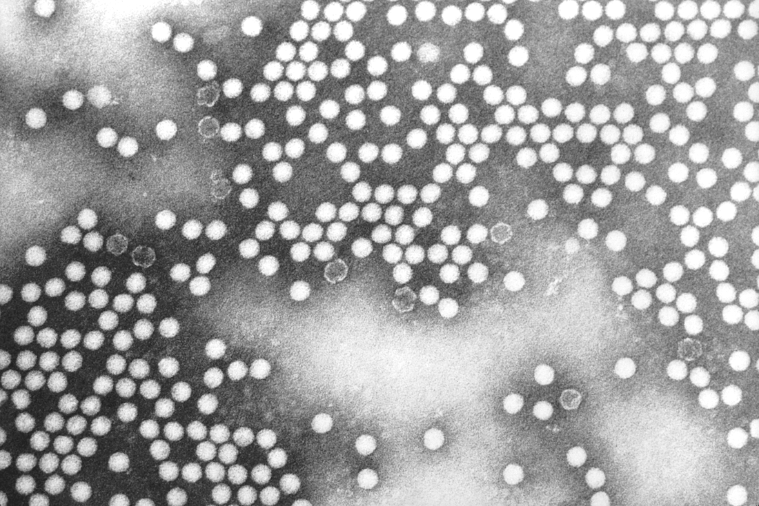 This transmission electron microscopic (TEM) image depicts poliovirus type-1 virions.