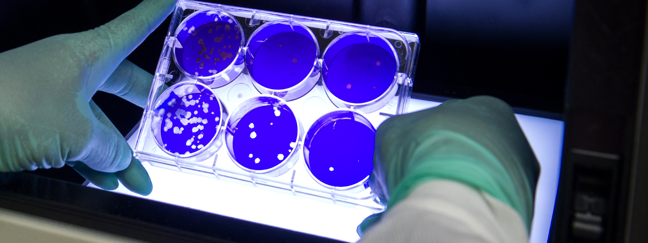 Person looking a lab container with 6 ring cups over a light