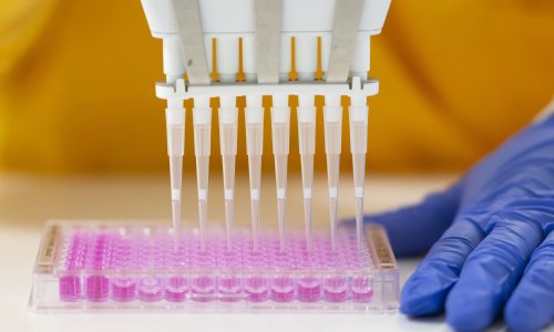 Photo: Matthew Horwood/Getty Images