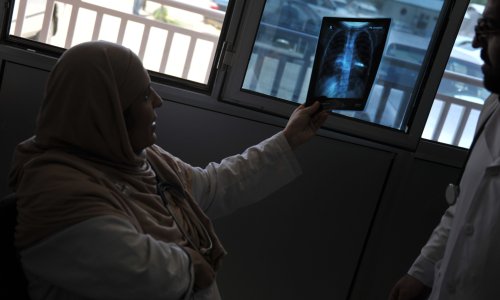 Photo: BAY ISMOYO/AFP/GettyImages